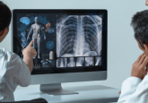 3 doctors gathered around a computer screen showing a full body x-ray with a close up of the lungs and ribs, neck, skull and hand. To represent that the HealthTree Research Hub provides RWD to multiple myeloma researchers.