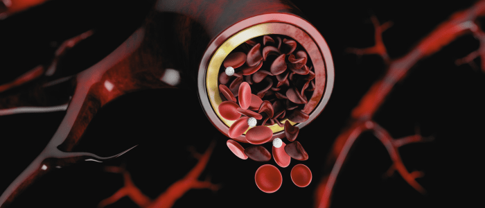 Image of a vein cut in half to show it is filled with red blood cells, some of which are sickle shaped and darker in colour. To represent that ASH RC and FDA Foundation to advance RWE research in SCD.